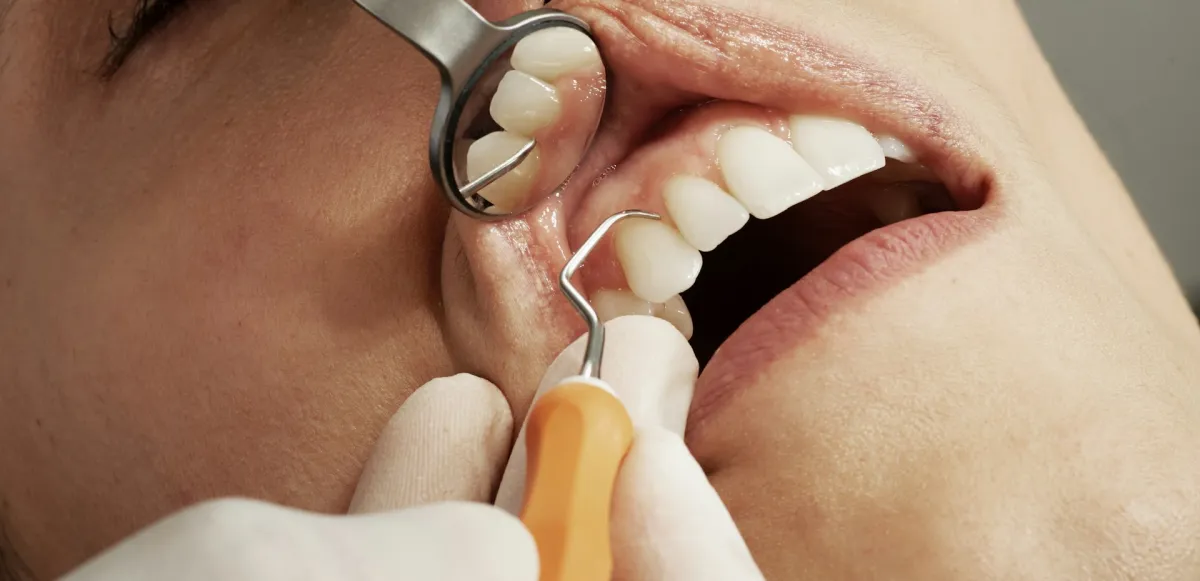 Exploración de dientes y encías con espejo e instrumental dental