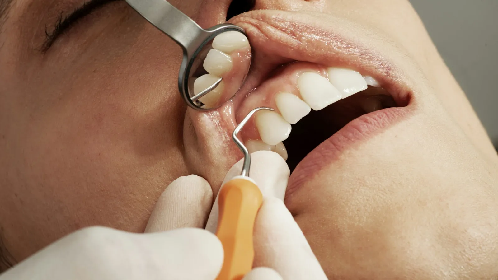Exploración de dientes y encías con espejo e instrumental dental