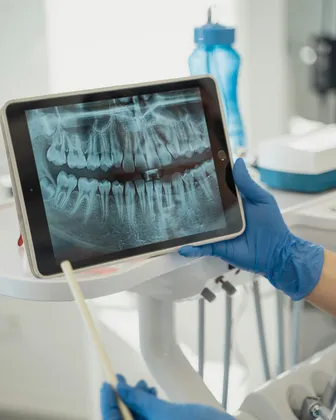 Radiografia boca