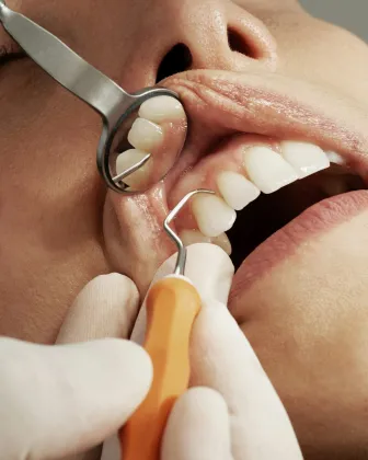 Exploración de dientes y encías con espejo e instrumental dental