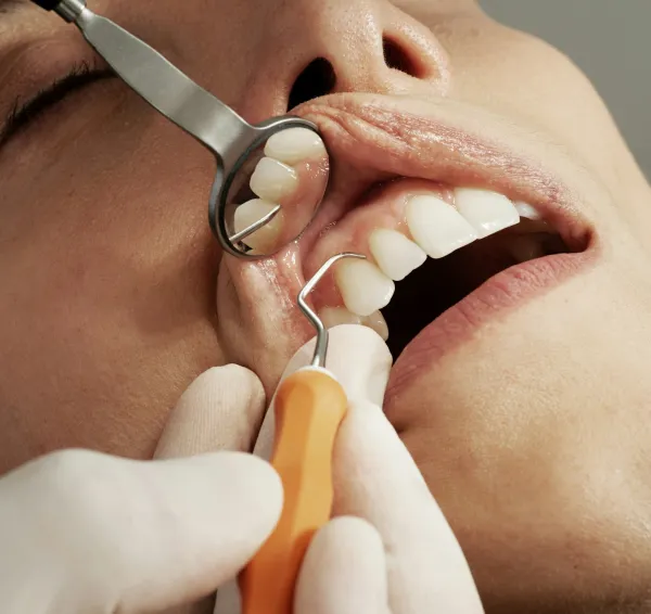 Exploración de dientes y encías con espejo e instrumental dental